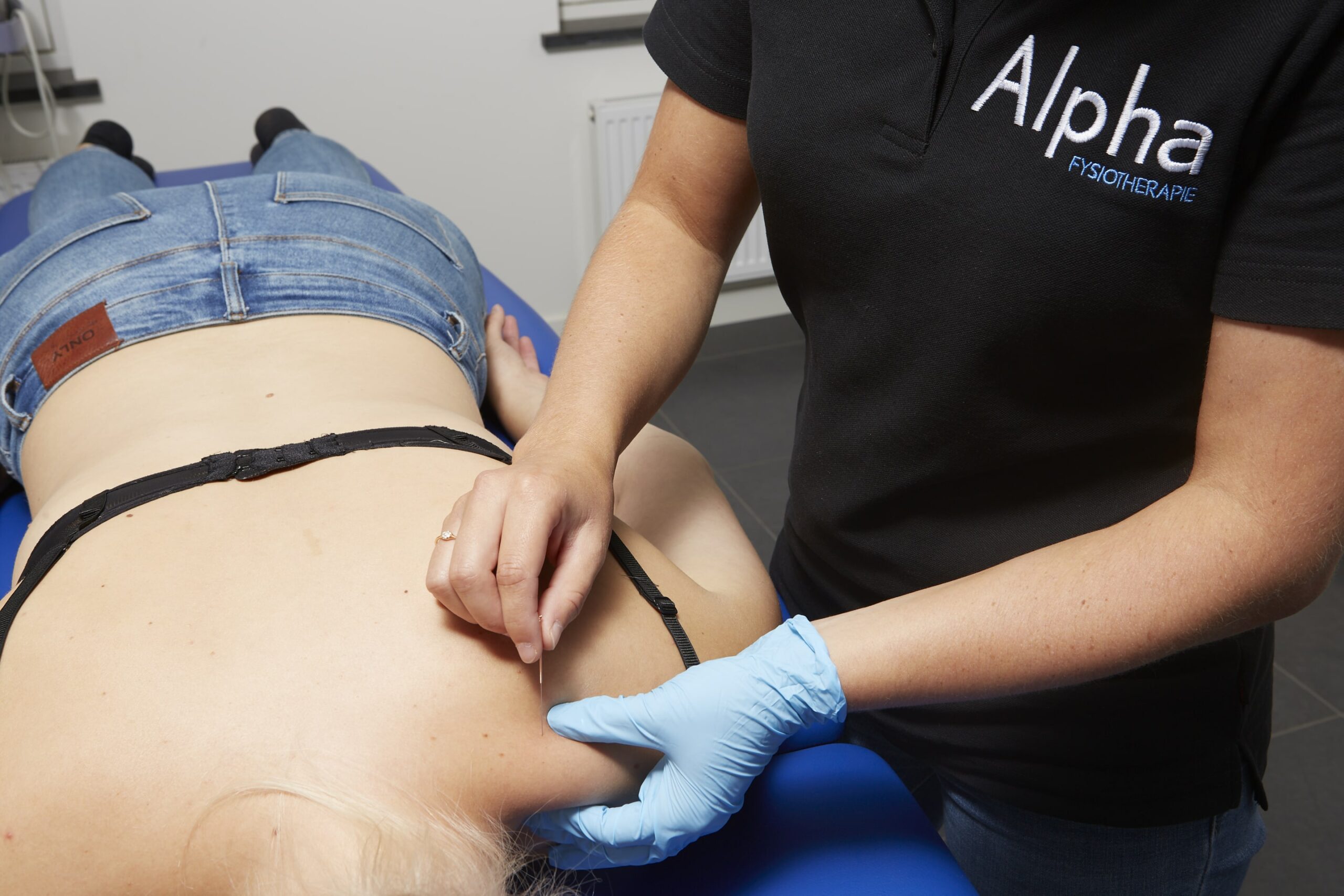 Dryneedling