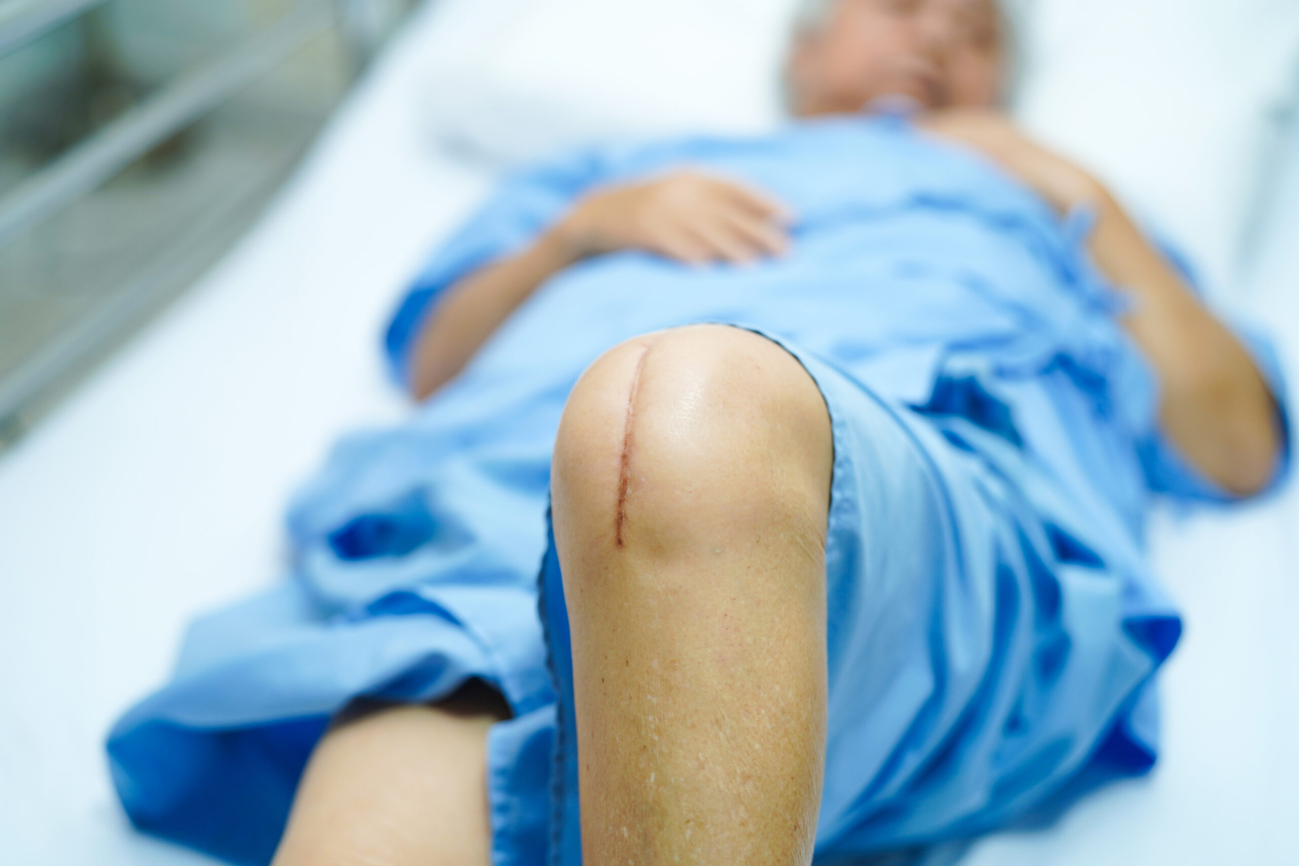 nieuwe_knie